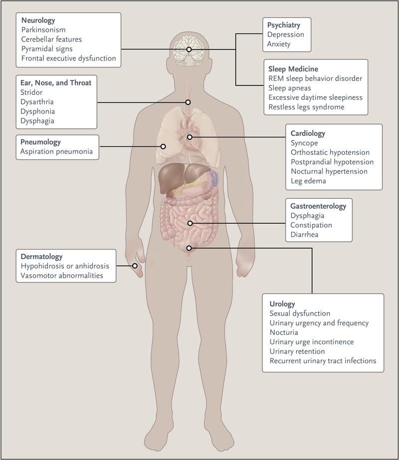 Multiple System Atrophy (MSA) | Movement Disorders Clinic