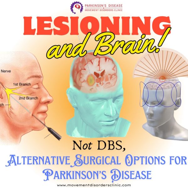 Lesionig CyberKnife Radiosurgery Explained: Clarifying the 15-Minute Parkinson’s ...